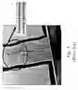 Fig. 09 - METHOD FOR REDUCING TOP NOTCHING EFFECTS IN PRE-DOPED GATE STRUCTURES