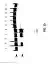 Fig. 48 - Reactions on a solid surface