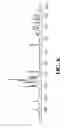 Fig. 07 - Salt forms of [R-(R*,R*)]-2-(4-fluorophenyl)-beta, delta-dihydroxy-5-(1-methylethyl)-3-phenyl-4-[(phenylamino)carbonyl]-1H-pyrrole-1-heptanoic acid