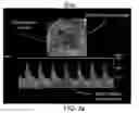 Fig. 04 - AUTOMATED MOVEMENT DETECTION WITH AUDIO AND VISUAL INFORMATION