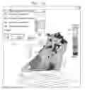 Fig. 09 - Automated pace-mapping for identification of cardiac arrhythmic conductive pathways and foci