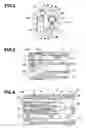 Fig. 03 - Method of treatment with endoscope