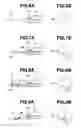 Fig. 05 - Method of treatment with endoscope