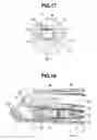 Fig. 09 - Method of treatment with endoscope