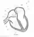 Fig. 04 - VASCULAR OCCLUSION DEVICE