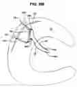 Fig. 08 - Methods and devices for repairing tissue