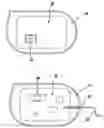 Fig. 01 - CONTACT MODULE FOR A MEDICAL IMPLANT