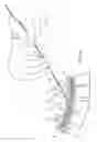 Fig. 06 - Apparatus for implanting an electrical stimulation lead