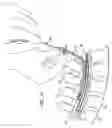 Fig. 10 - Apparatus for implanting an electrical stimulation lead