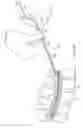 Fig. 16 - Apparatus for implanting an electrical stimulation lead