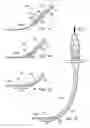 Fig. 17 - Apparatus for implanting an electrical stimulation lead