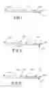 Fig. 02 - SINGLE AND MULTIPOLAR IMPLANTABLE LEAD FOR SACRAL NERVE ELECTRICAL STIMULATION