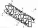 Fig. 01 - Endoprostheses including metal matrix composite structures