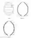Fig. 03 - ENDOVASCULAR DEVICES TO PROTECT ANEURYSMAL WALL