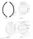 Fig. 08 - ENDOVASCULAR DEVICES TO PROTECT ANEURYSMAL WALL