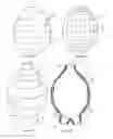 Fig. 09 - ENDOVASCULAR DEVICES TO PROTECT ANEURYSMAL WALL