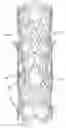 Fig. 01 - Hybrid stent and method of making