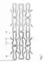 Fig. 02 - ENDOVASCULAR IMPLANT WITH ACTIVE COATING