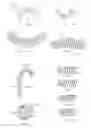 Fig. 05 - Medical device delivery sheath