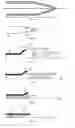 Fig. 14 - Medical device delivery sheath