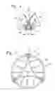 Fig. 04 - Methods of implanting two-part heart valves