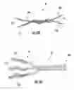Fig. 06 - Woven and/or braided fiber implants and methods of making same