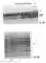 Fig. 13 - Woven and/or braided fiber implants and methods of making same