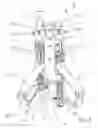 Fig. 02 - Device and method for ascertaining the force-displacement characteristic curve of one or more ligaments