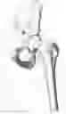 Fig. 03 - Aspheric hip bearing couple