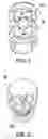 Fig. 04 - Methods of making shaped load-bearing osteoimplant