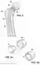 Fig. 05 - Methods of making shaped load-bearing osteoimplant