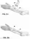Fig. 07 - Methods of making shaped load-bearing osteoimplant
