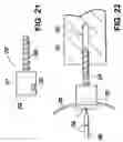 Fig. 13 - Methods of making shaped load-bearing osteoimplant