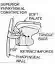 Fig. 01 - Methods and devices for treating sleep apnea and snoring