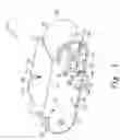 Fig. 02 - Vacuum Traction Device System and Method of Use