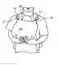 Fig. 01 - BLANKET WITH ATTACHMENT CLIPS