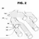 Fig. 03 - Stent Ring Surface Formation
