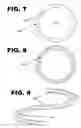 Fig. 06 - Stent Ring Surface Formation