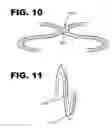 Fig. 07 - Stent Ring Surface Formation