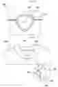 Fig. 13 - Knit material collar for preventing an extension, producing method thereof, and upper garment with the collar