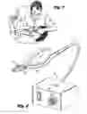 Fig. 02 - Heated dental pliers