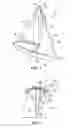 Fig. 02 - System and method of adjusting the location and position of the foresail on a sailboat