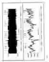 Fig. 03 - Method and apparatus for diagnosing respiratory disorders and determining the degree of exacerbations