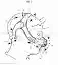Fig. 02 - Mask Assembly