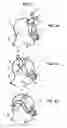 Fig. 04 - Mask Assembly