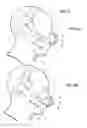 Fig. 05 - Mask Assembly