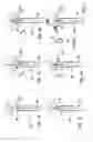 Fig. 04 - Bronchus blocker and artificial respiration system
