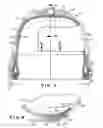 Fig. 03 - Infant nasal cannula