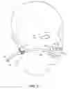 Fig. 13 - Nasal and oral patient interface