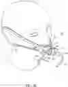 Fig. 16 - Nasal and oral patient interface
